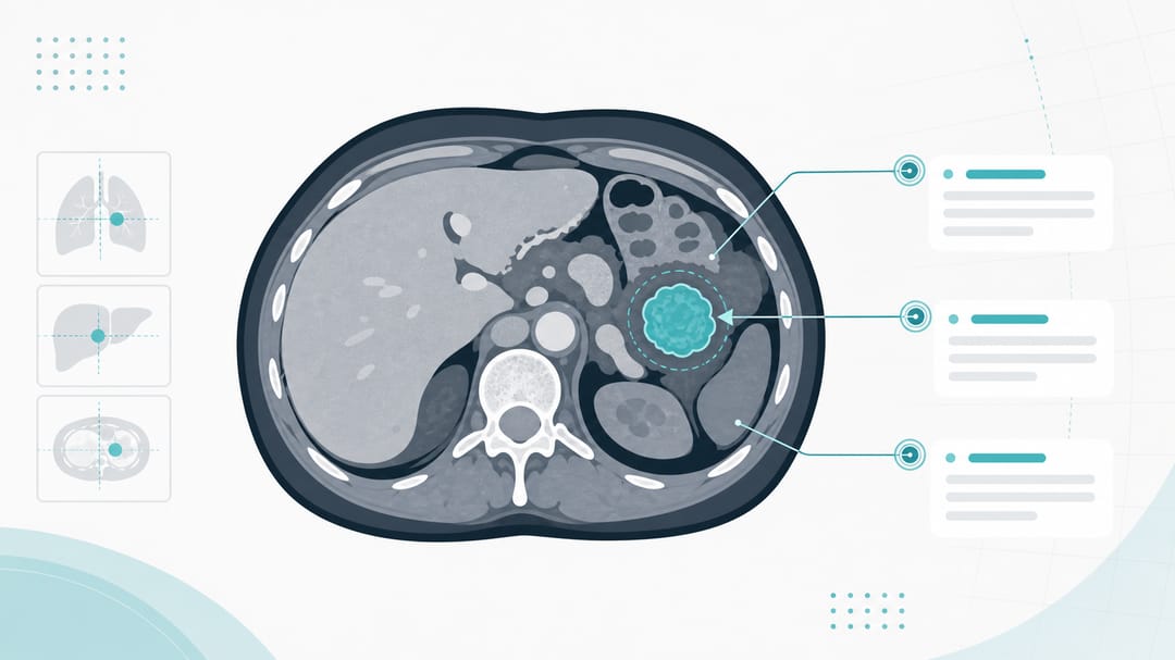 Redaktionell gestaltetes Titelbild: eine Thorax-CT-Schicht mit beschrifteter Läsion, Verweispfeilen und einem anatomischen Schema daneben