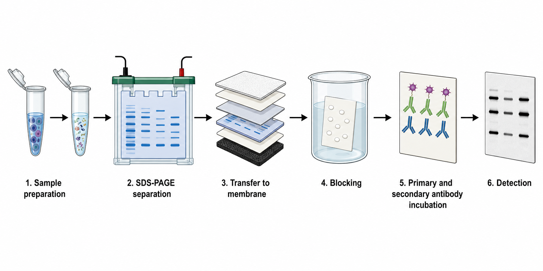 Describe tu figura de western blot
